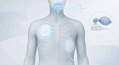 CPR Simulation Finds Little Oxygen Build Up Before Defibrillation
