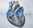 weight loss trial in older adults with persistent atrial fibrillation