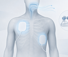 CPR Simulation Finds Little Oxygen Build Up Before Defibrillation