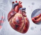 Illustrated heart showing rheumatoid arthritis related cardiovascular complications and heart failure