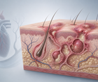 cardiovascular risk in hidradenitis suppurativa