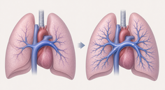 sequential add on therapy and risk reclassification in group 1 4 pah