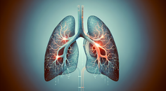 hi peitho trial reports lower early pe events with fibrinolysis