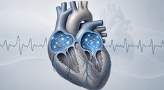 weight loss trial in older adults with persistent atrial fibrillation