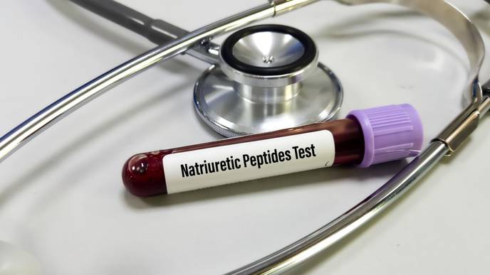 Study Shows B-Type Natriuretic Peptides Lose Prognostic Value For ...